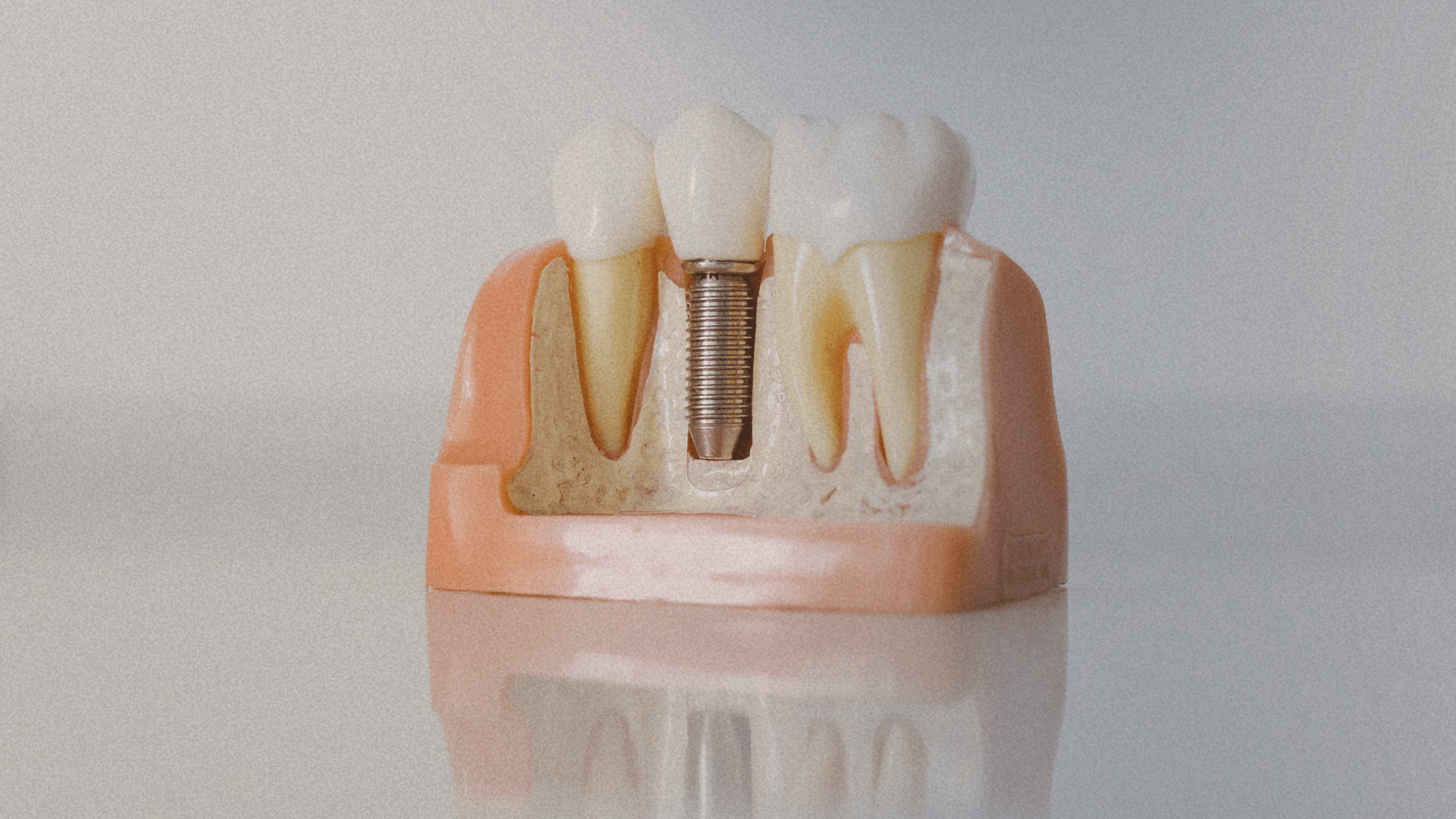 Marketing fără buget de promovare? Te păcălești singur.